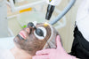 Carbon laser facial treatment - Our Treatments - ABC Clinic abcclinc